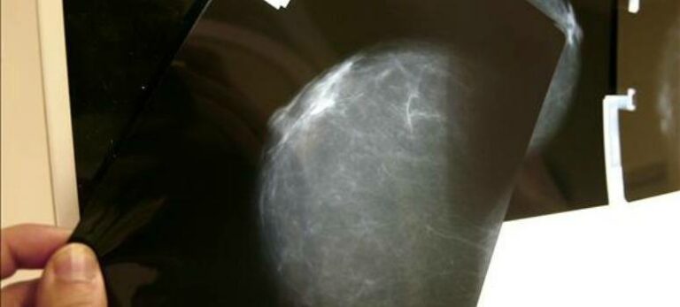 Cáncer